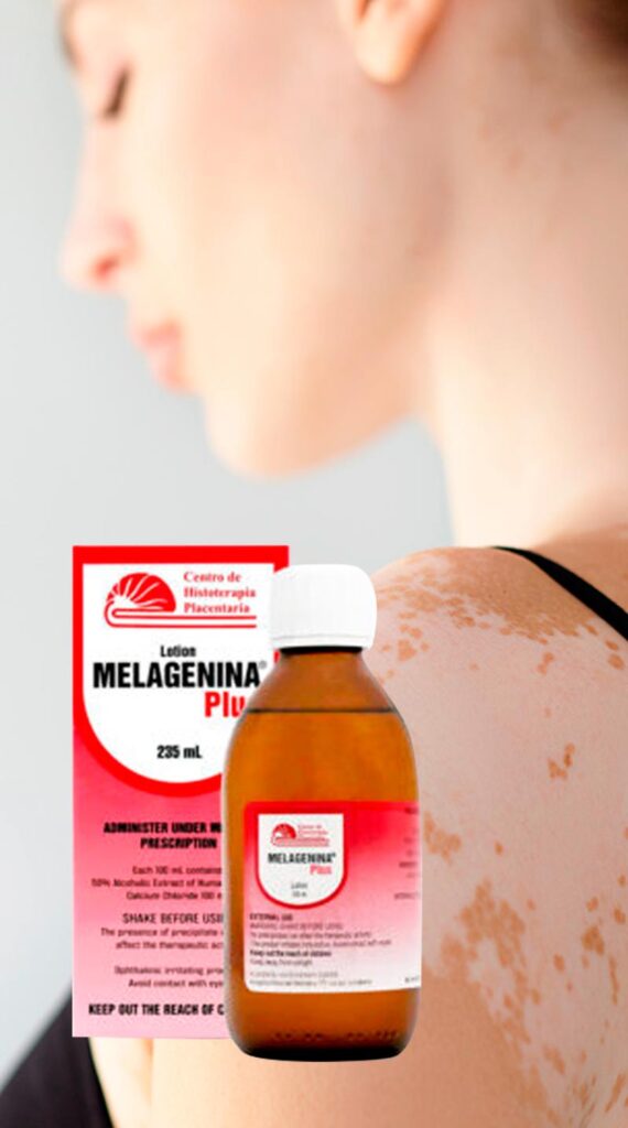 beneficios de melagenina plus - tratamiento cubano